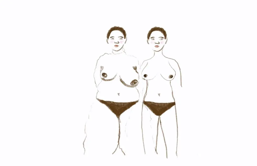 Sisters not twins illustration of how my surgeon sees me vs. how I actually look