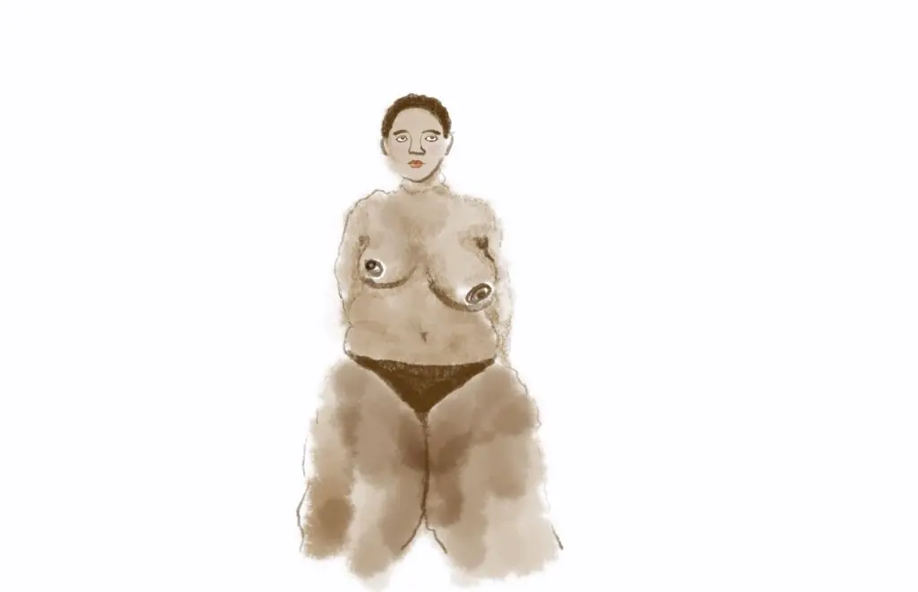 How my surgeon portrayed me in my consult report
