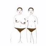 Sisters not twins illustration of how my surgeon sees me vs. how I actually look