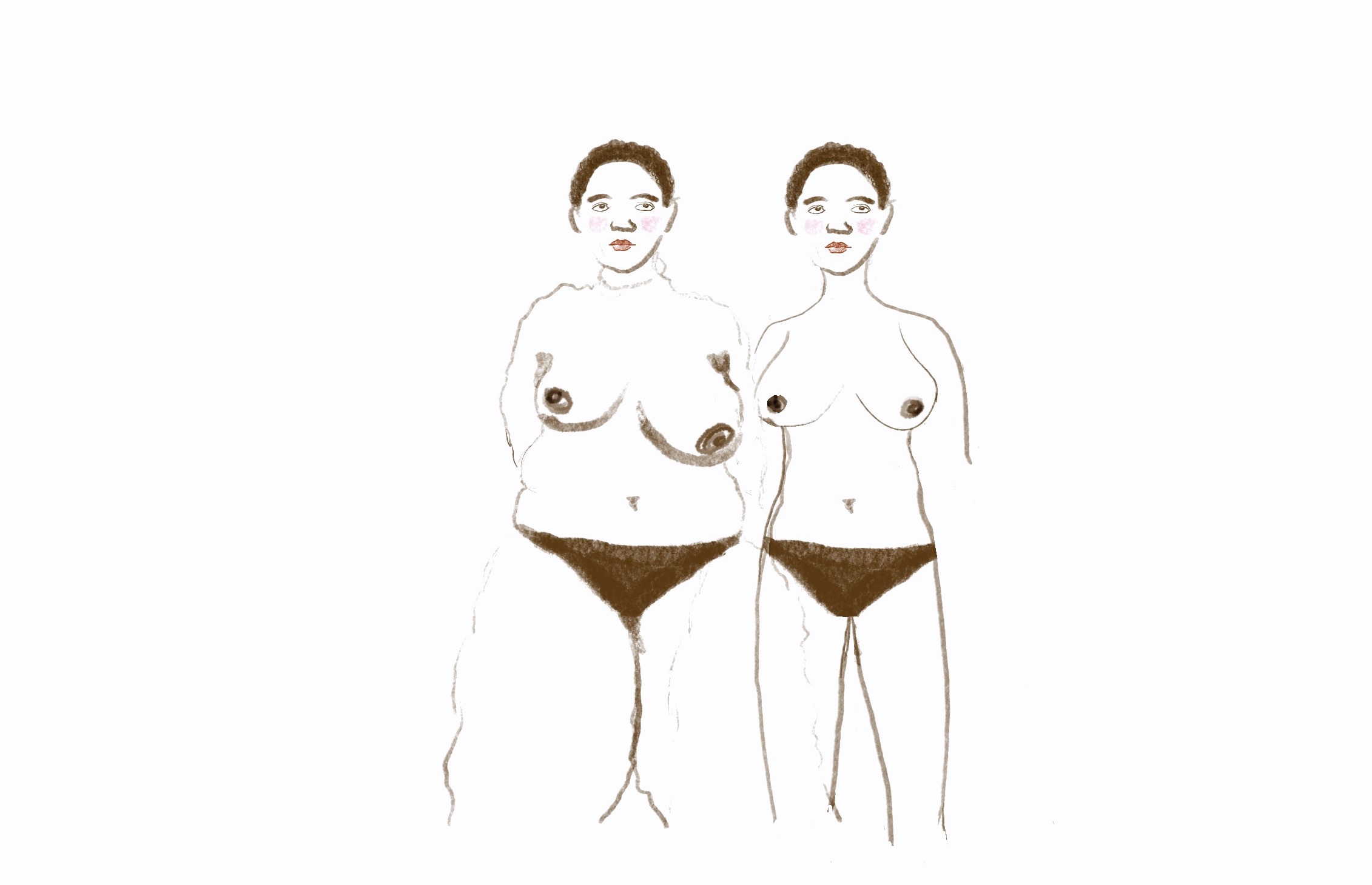 Sisters not twins illustration of how my surgeon sees me vs. how I actually look