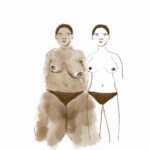 Sisters not twins illustration of how my surgeon sees me vs. how I actually look