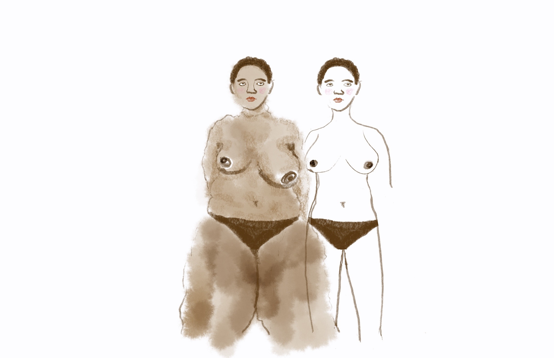 Sisters not twins illustration of how my surgeon sees me vs. how I actually look